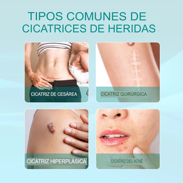 SPRAY CICATRICES!