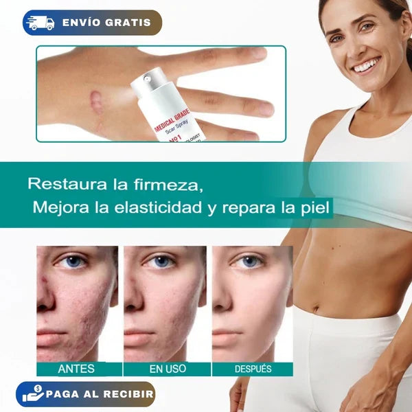 SPRAY CICATRICES!